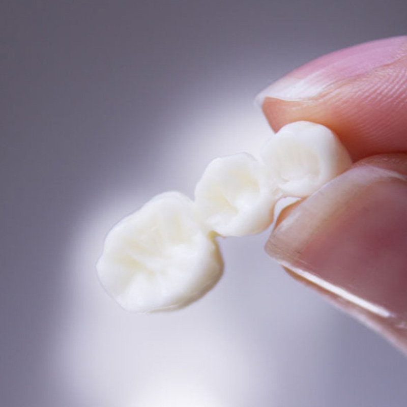 Fingers holding Teeth Bridges